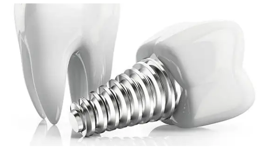 dental implants Adelaide