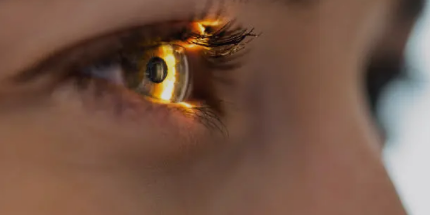 LASIK eye surgery
